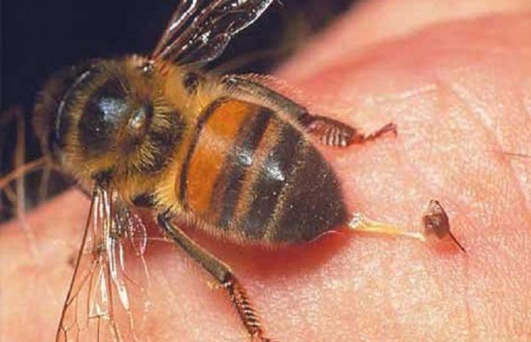 На Хмельниччині бджоли до смерті закусал…