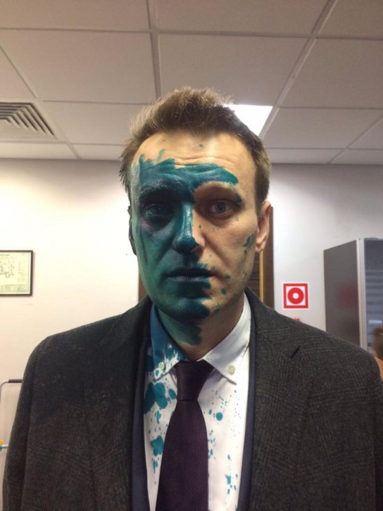 Навальному пропалили око зеленкою…
