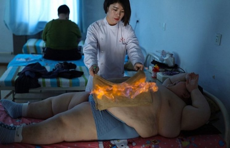 У Китаї дитину, яка важить 150 кілограмі…