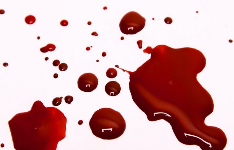В Ровно священникам УПЦ пустили кровь…