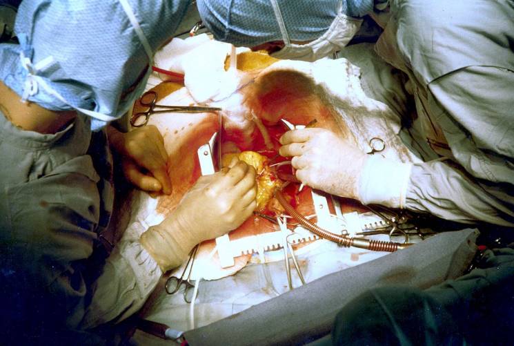 Вперше кардіохірурги Тернопільщини прове…
