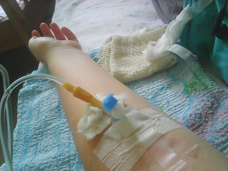 Спалах гепатиту А в Миколаєві: в лікарня…