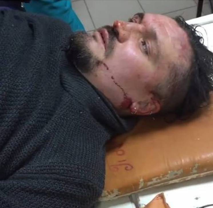 В Запорожье битами избили активиста, кот…