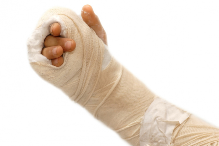 У київському ТРЦ дівчинка зламала руку,…