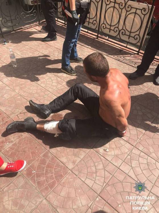 У Києві поліцейські прострелили ногу чол…