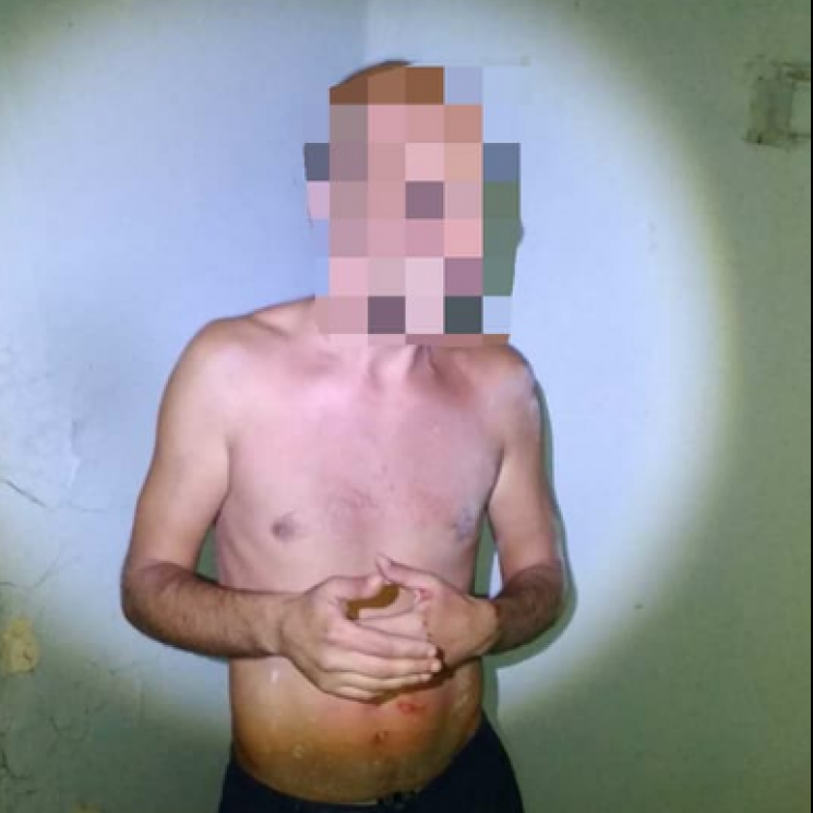 У Кропивницькому 33-річний чоловік поріз…