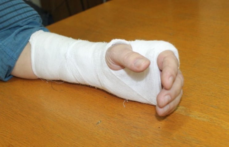В Херсоне помощник нардепа сломал руку ж…