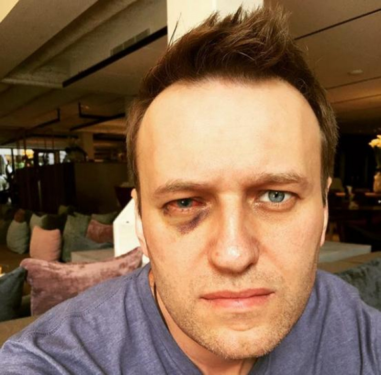 Навальному прооперували око в Барселоні…