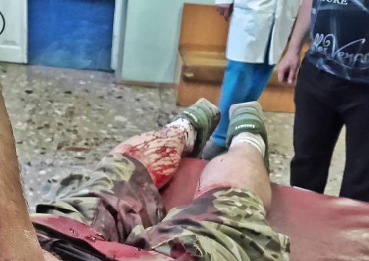У Києві четверо нападників всадили ніж у спину «кіборгу»