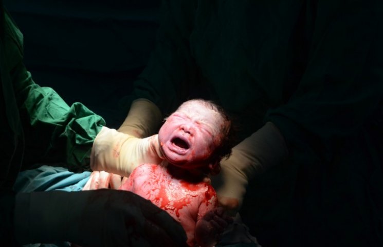 Врачам удалось спасти нерожденного ребен…