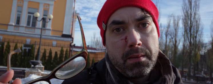 В Киеве радикалы избили канадского журна…