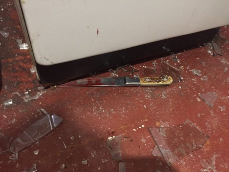 На Харківщині чоловік ударив дружину нож…