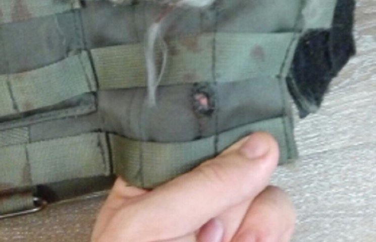 З'явилося фото поранених солдатів під ча…