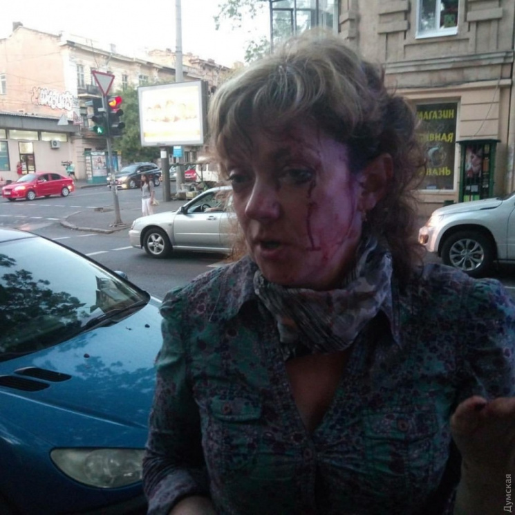 В Одесі побили активістку, яка боролася…