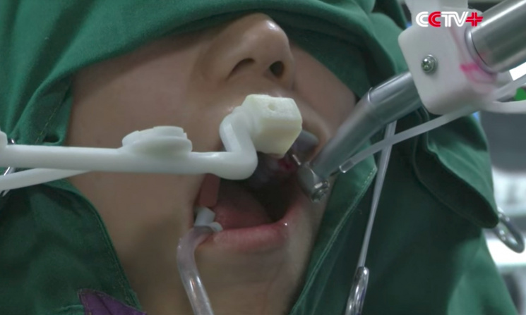 У Китаї робот замінив стоматолога…